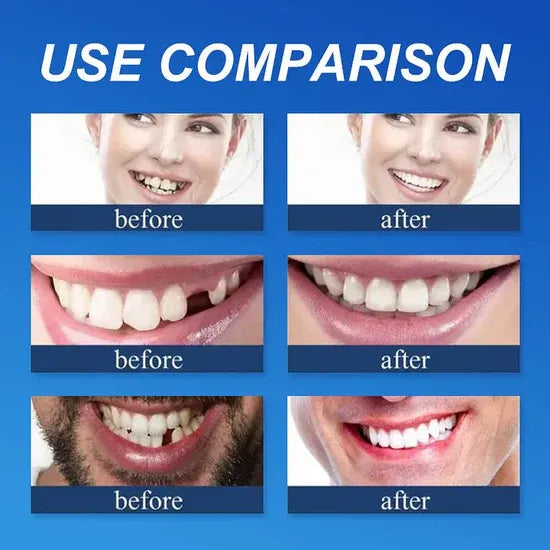 ⏰Ends Today: 70% OFF! 🌎Demorva™ Medical Full Denture with Strong Suctiond🦷Obtain American Dental Association (ADA) Certification