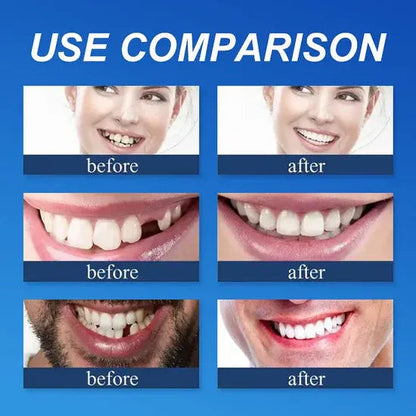 ⏰Ends Today: 70% OFF! 🌎Demorva™ Medical Full Denture with Strong Suctiond🦷Obtain American Dental Association (ADA) Certification