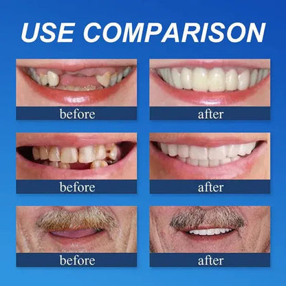 ⏰Ends Today: 70% OFF! 🌎Demorva™ Medical Full Denture with Strong Suctiond🦷Obtain American Dental Association (ADA) Certification