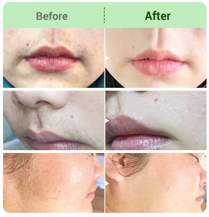 SmoothPro Fast Hair Removal Cream