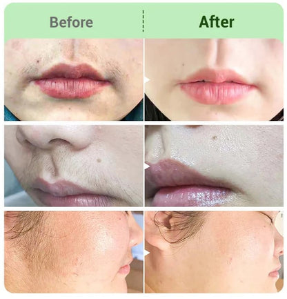 SmoothPro Fast Hair Removal Cream