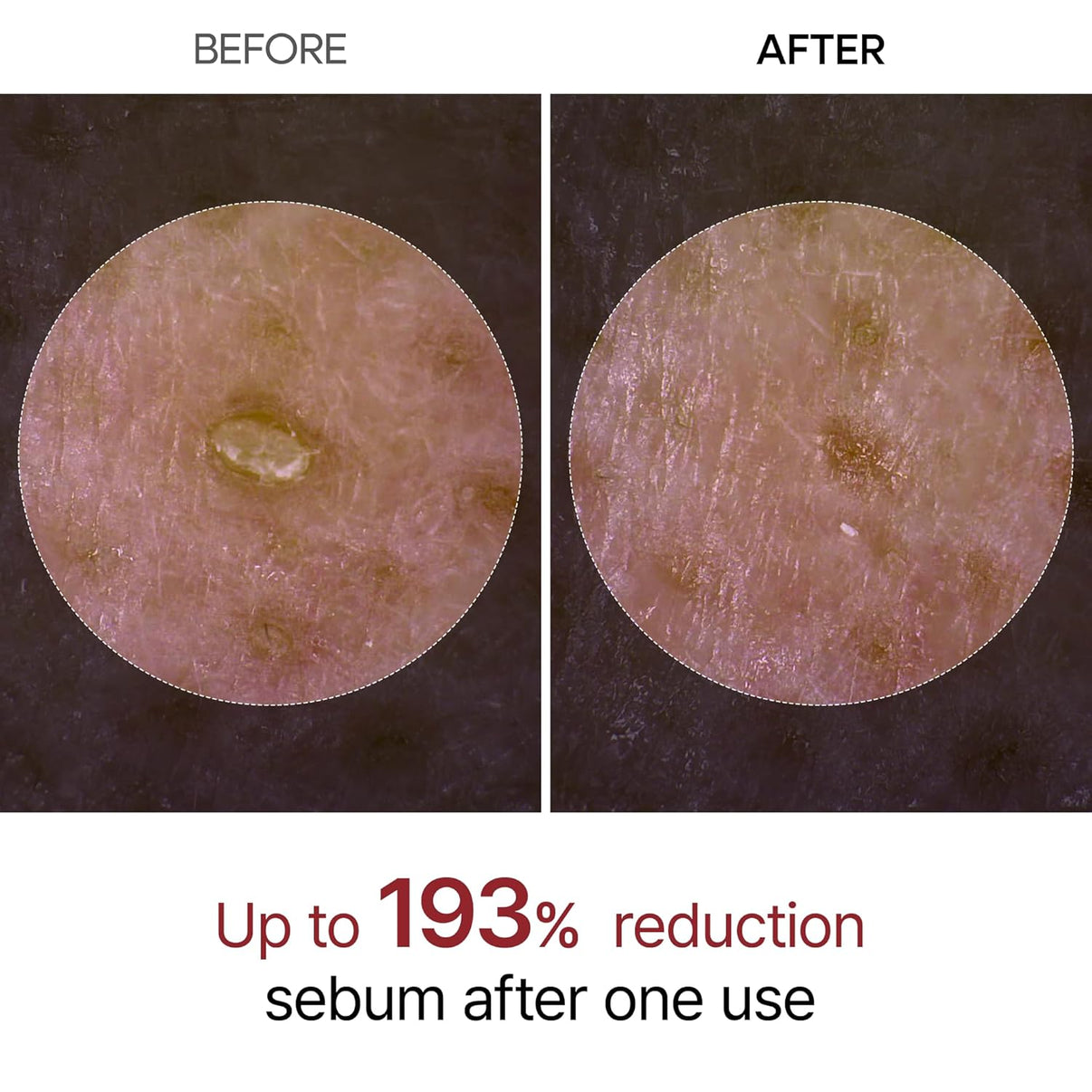 Radiant Rice Peel Duo