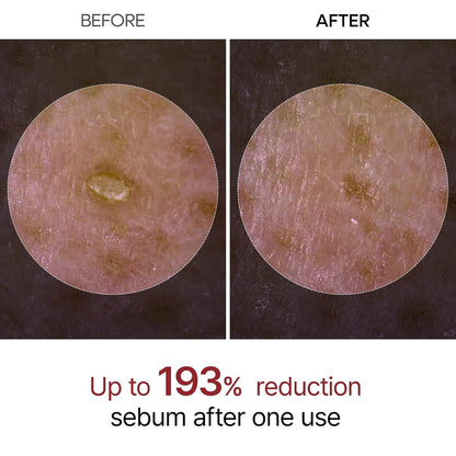 Radiant Rice Peel Duo