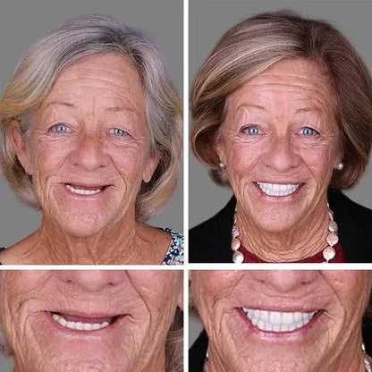 ⏰Ends Today: 70% OFF! 🌎Demorva™ Medical Full Denture with Strong Suctiond🦷Obtain American Dental Association (ADA) Certification